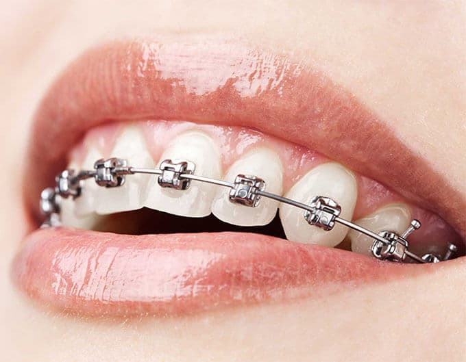 dental